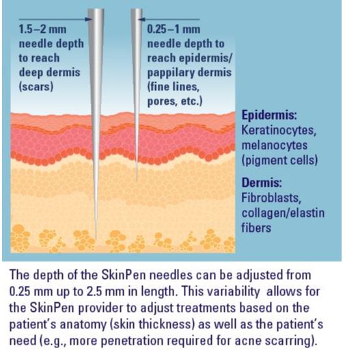 SkinPen Microneedling Treatments Pittsburgh